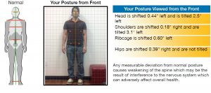 crooked posture scan
